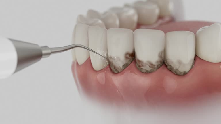 Trusted Emergency Dentist service in Parklawn, CA - Dentist Open Now